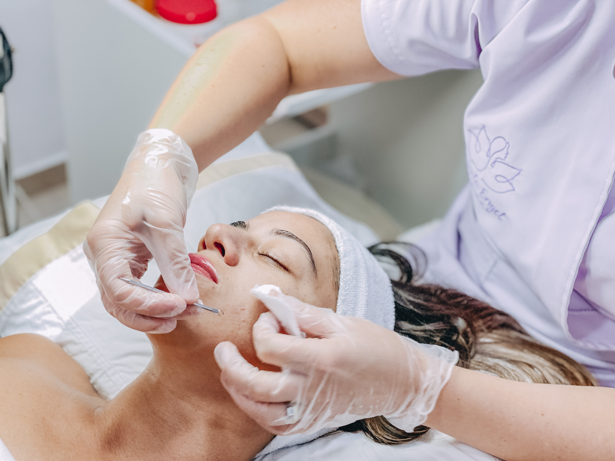 Electroporación facial